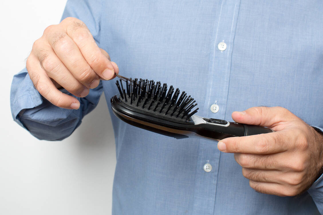 Wenn vermehrt Haare in der Bürste zu finden sind, könnte das auch am Rauchen liegen. / Foto: Adobe Stock/Adam Gregor