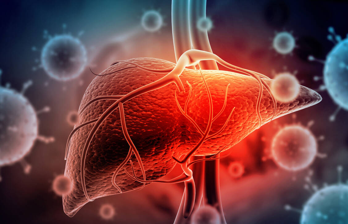 Folgen einer chronischen Hepatitis B können Leberzirrhose und Leberkrebs sein. / © Getty Images/Rasi Bhadramani