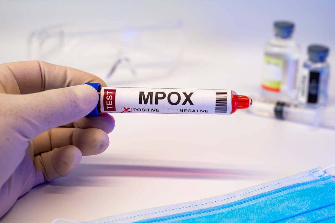 Die WHO rät dringend, die Überwachung der Mpox-Fälle und Laborkapazitäten aufrechtzuerhalten. / Foto: Adobe Stock/JUN LI