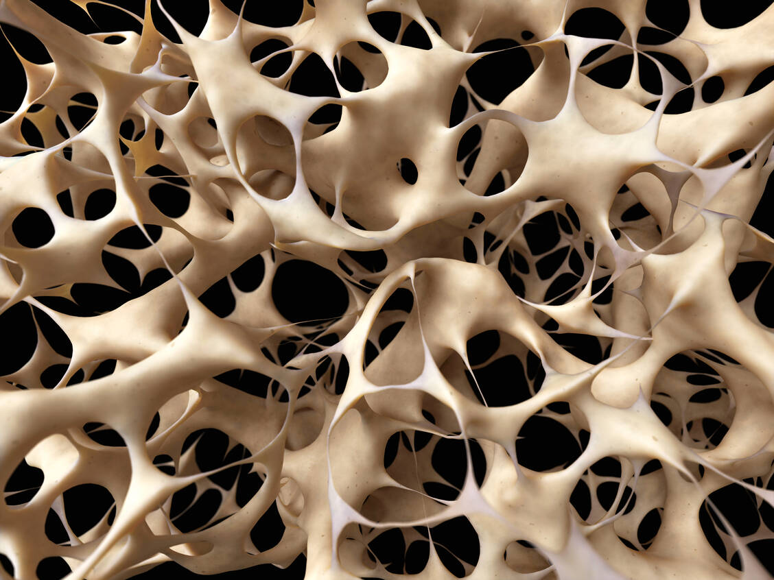 Knochenschwund bringt millionenfach großes Leid und belastet das Gesundheitssystem stark. / Foto: Shutterstock/SebastianKaulitzki