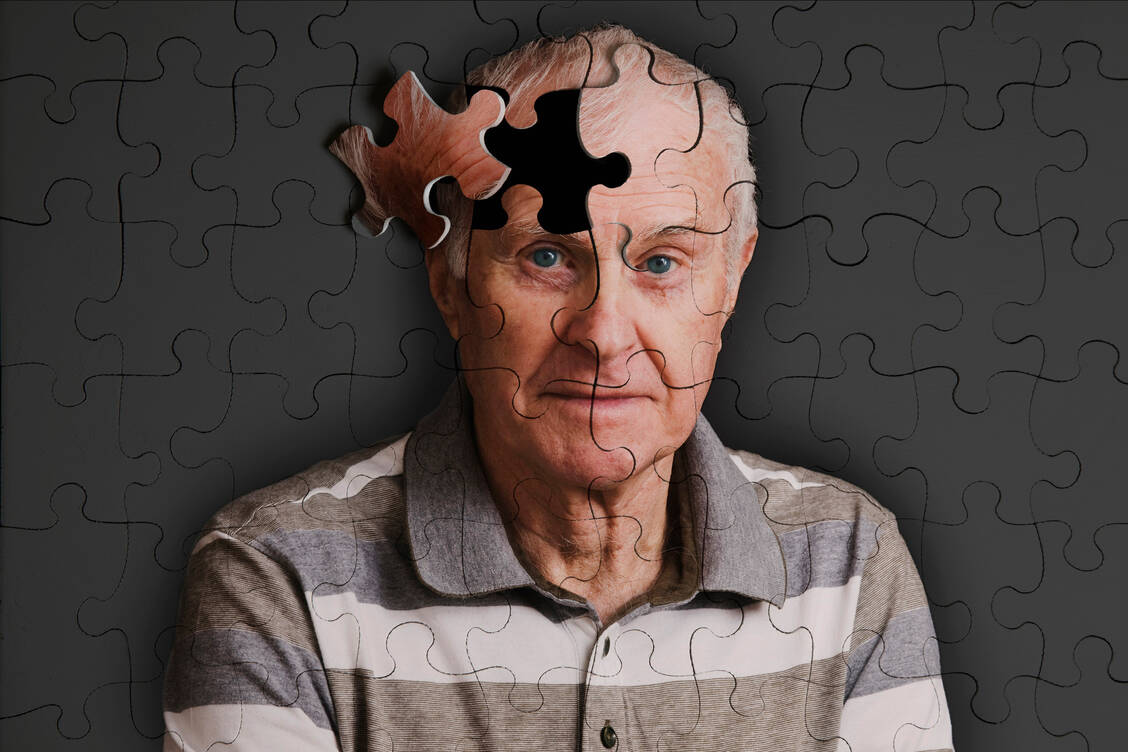 Das Medikament zielt auf sogenannte Amyloid-Plaques,  die schon Jahre vor den ersten Alzheimer-Symptomen auftreten.  / Foto: GettyImages/ Andrew Bret Wallis