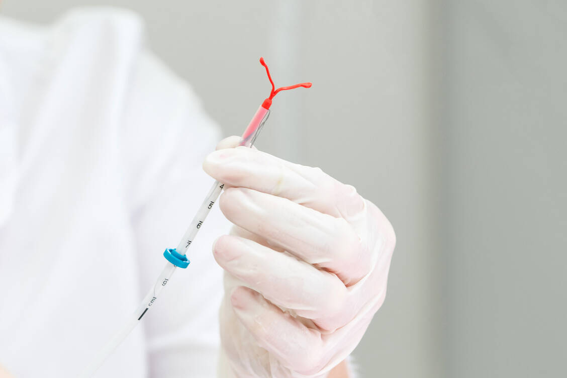 Ein Studie untersuchte die Endometriumdicke im Hinblick auf die frühere Verwendung verschiedener Verhütungsmittel. / © Shutterstock/mariakray