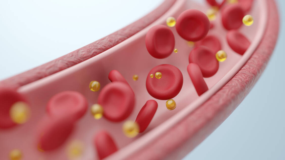 Beim seltenen familiären Chylomikronämie-Syndrom reichern sich große Mengen Triglyceride im Blut an. / © Adobe Stock/piyaset