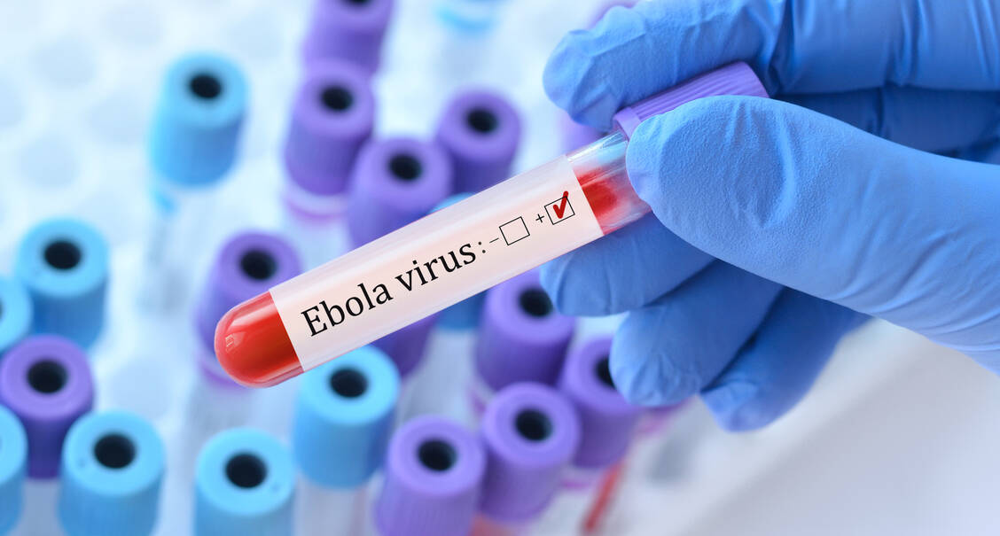 In Frankreich ist ein erster Ebola-Fall aufgetreten. Es handelte sich um einen Arzt, der in der betroffenen Region des Kongo humanitäre Hilfe geleistet hatte. / © Getty Images/SyhinStas