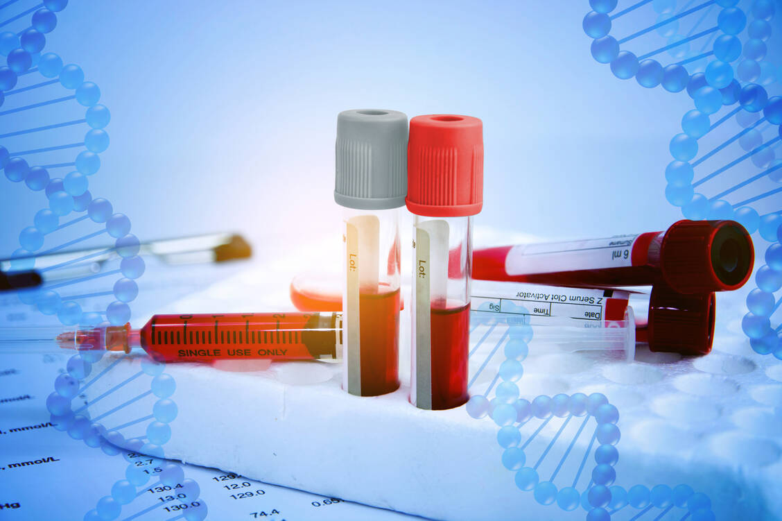 Eine Hämophilie wird durch einen Mangel an bestimmten Gerinnungsfaktoren verursacht. / © Adobe Stock/blindturtle