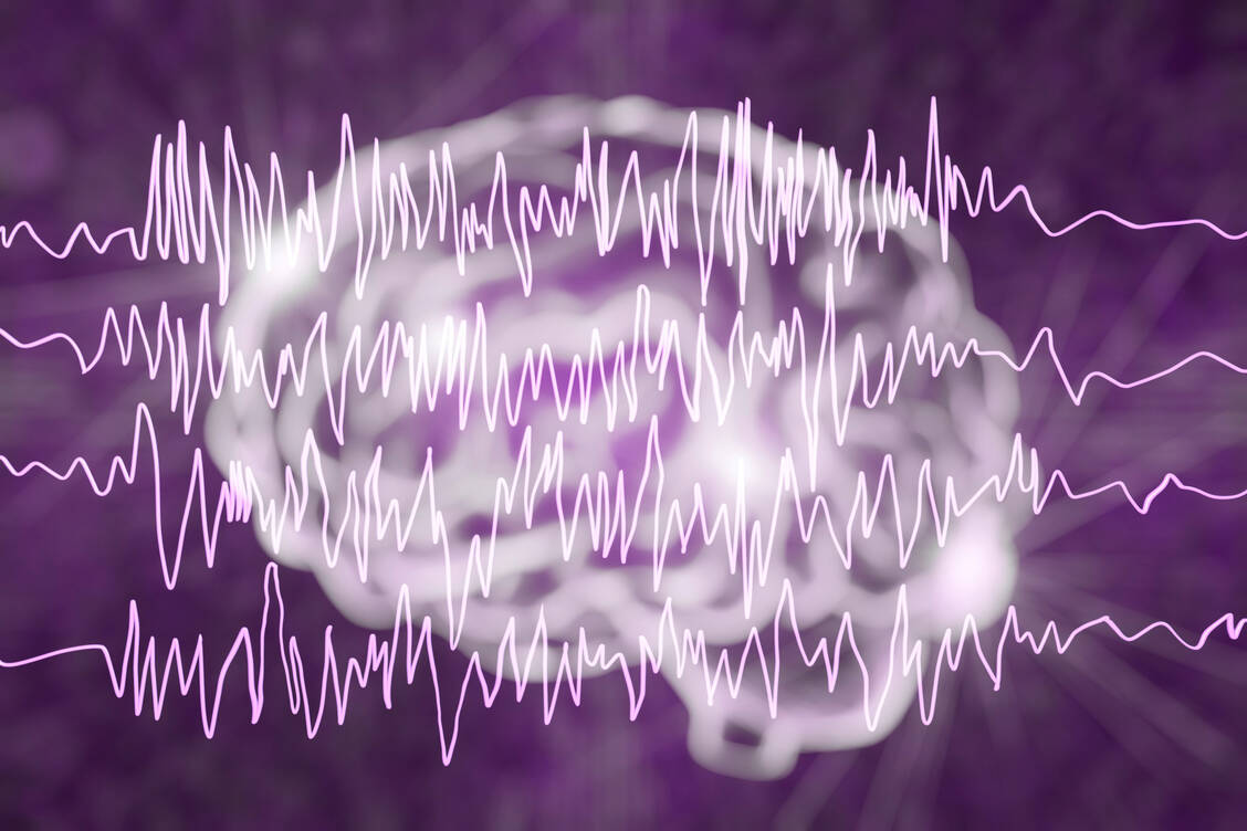Es gibt plötzliche, unerwartete Todesfälle bei Epilepsiepatienten. Diese werden in der Medizin SUDEP genannt. / © Adobe Stock/ Kateryna_Kon (Symbolbild)