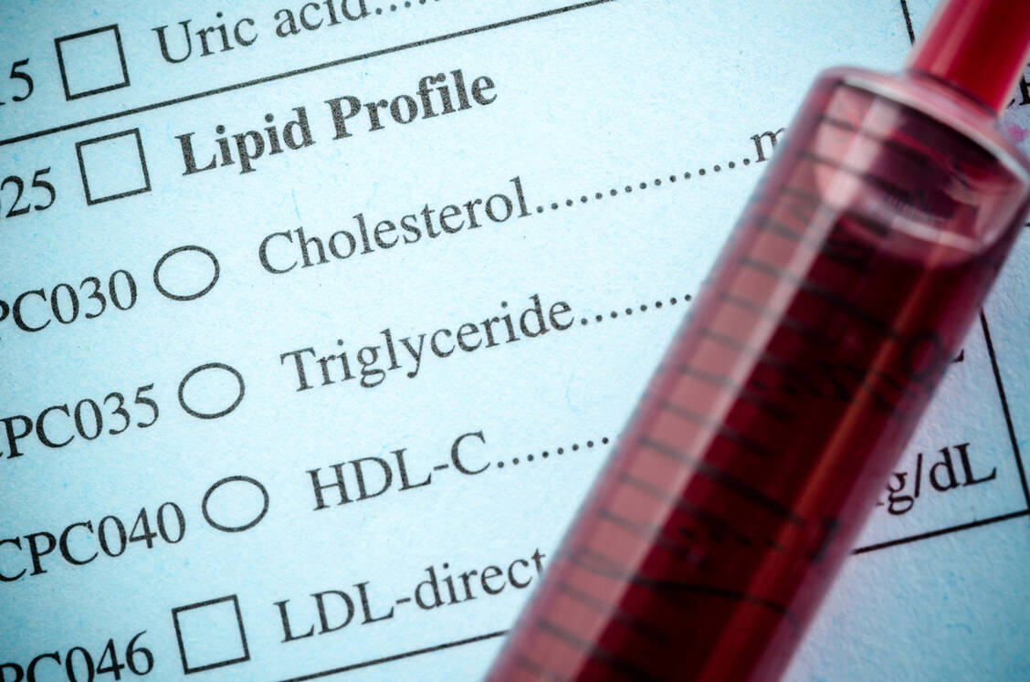 Beim Lipidprofil werden der Cholesterolgehalt, aufgetrennt in HDL-, LDL- und Gesamt-Cholesterol , zudem die Triglyceridwerte bestimmt. / Foto: Adobe Stock/gamjai