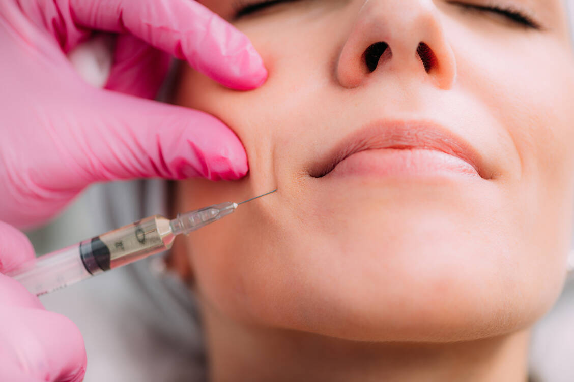 Filler sollten nur von gut ausgebildeten Behandlern gespritzt werden. / Foto: Adobe Stock/Microgen