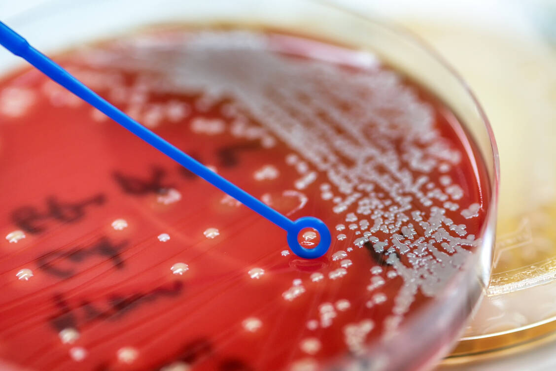 Antibiotikaresistenzen sind eine globale Gesundheitsbedrohung. Die Therapiemöglichkeiten bei Mensch und Tier werden dadurch stark eingeschränkt. / © Adobe Stock/analysis121980