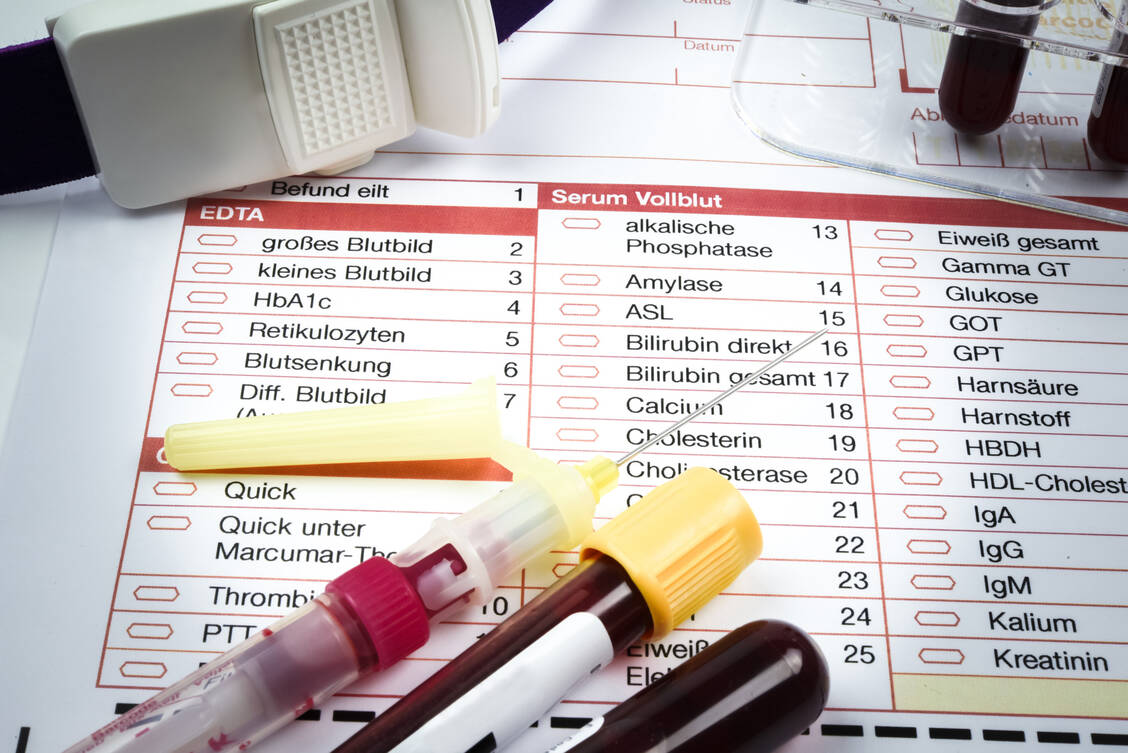 Ein erhöhtes Gamma-GT kann verschiedene Ursachen haben, die abzuklären sind. / © Adobe Stock/Countrypixel