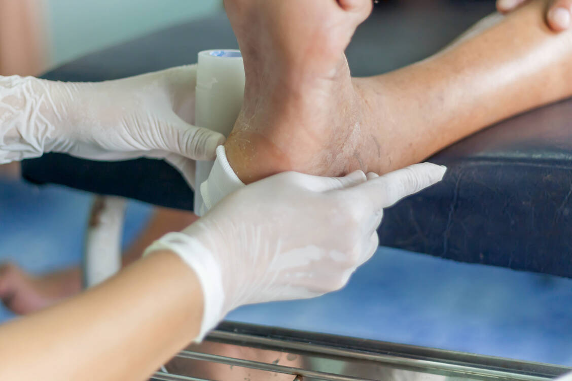 Die Versorgung chronischer Wunden etwa infolge eines Diabetischen Fußes muss ein Podologe übernehmen. / Foto: Shutterstock/Kirov1976