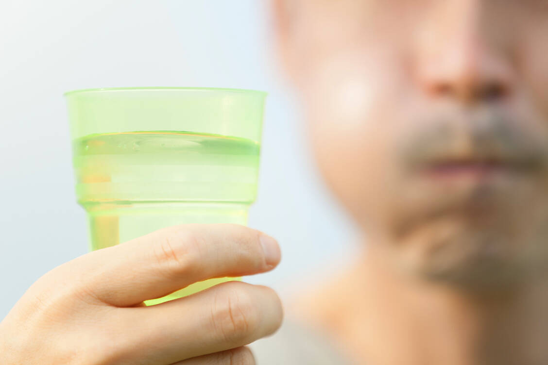 Antiseptische Mundspülungen könnten bei Diabetes von Vorteil sein – das deutet eine kleine Studie an. / Foto: Adobe Stock/carbondale