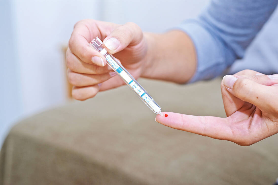 HIV-Selbsttests können einfach zu Hause durchgeführt werden. Benötigt wird nur ein Tropfen Blut aus der Fingerkuppe. / Foto: your photo today