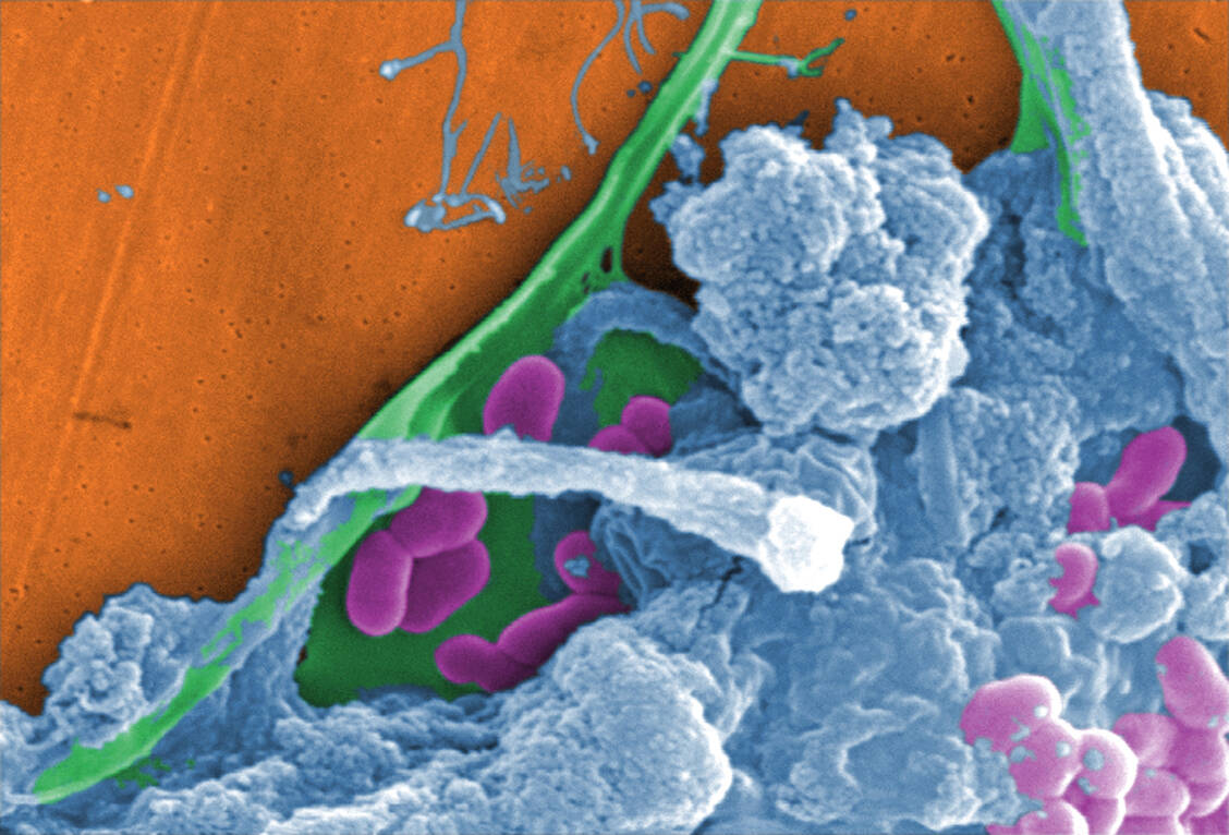 Biofilme stellen ein medizinisches Problem dar. Sie schützen die darin eingebetteten Bakterien vor dem Immunsystem und machen sie unempfindlicher gegen Antibiotika. / Foto: CDC