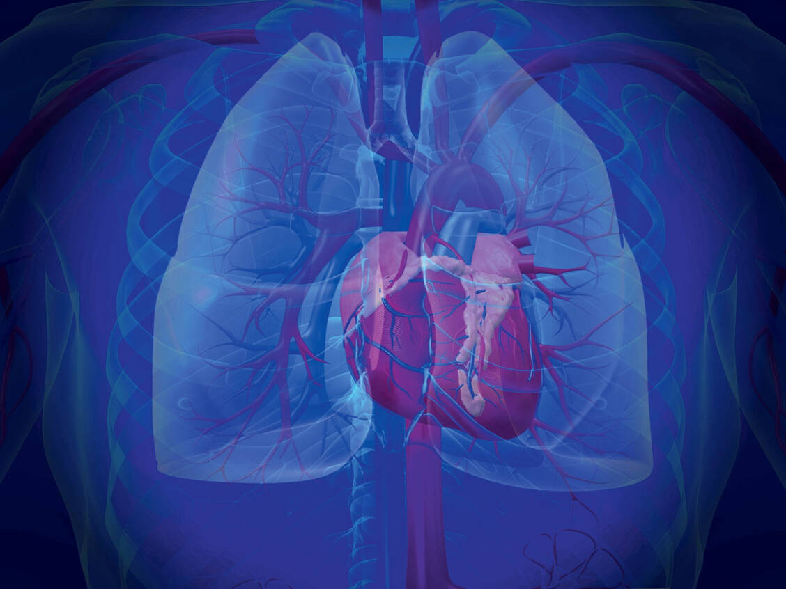 Bei der pulmonalen Hypertonie (PH) steigt der Druck in den Lungenarterien deutlich an. / Foto: Bayer