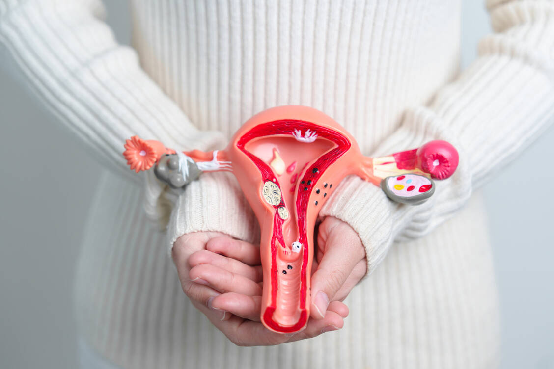 Bei einer Endometriose wächst Gebärmutter-artiges Gewebe außerhalb des Uterus. Das verursacht Schmerzen und kann in einigen Fällen zu Organschäden oder einer eingeschränkten Fruchtbarkeit führen. / © AdobeStock/Jo Panuwat D