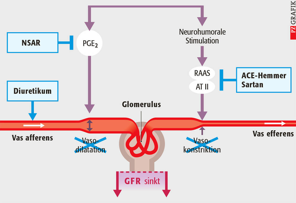 Grafik: Einfluss von nicht-steroidalen Antirheumatika (NSAR), Diuretika und RAAS-Hemmstoffen auf die Nierenfunktion. Die Dreifach-Kombination kann zum drastischen Abfall der Nierenleistung führen. / Foto: Grafik: Stephan Spitzer