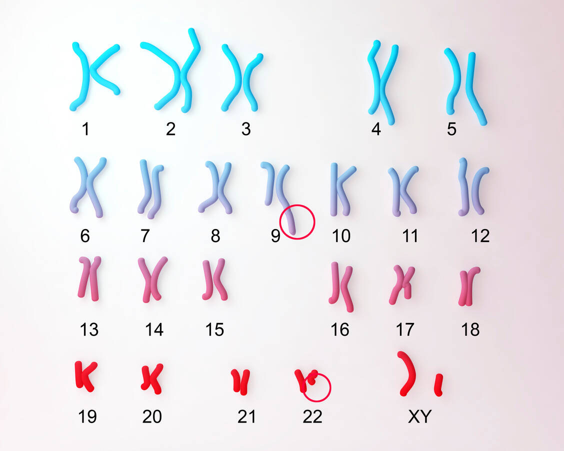 Bei fast allen CML-Patienten sind die Enden der Chromosomen 9 und 22 ausgetauscht. / Foto: Getty Images/Kateryna Kon