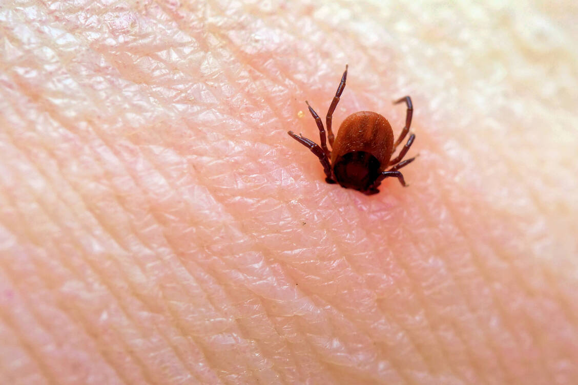 Tief eingegraben in die Haut gelangt infektiöses Sekret der Zecke relativ rasch in die Blutbahn. / Foto: Adobe Stock/JuergenL