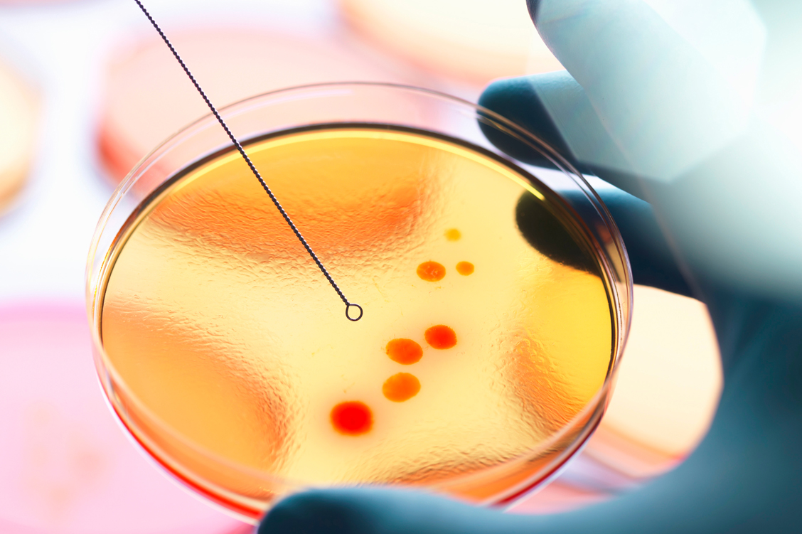 Zahlreiche Keime sind resistent gegenüber herkömmlichen Antibiotika. / Foto: Getty Images/Andrew Brookes