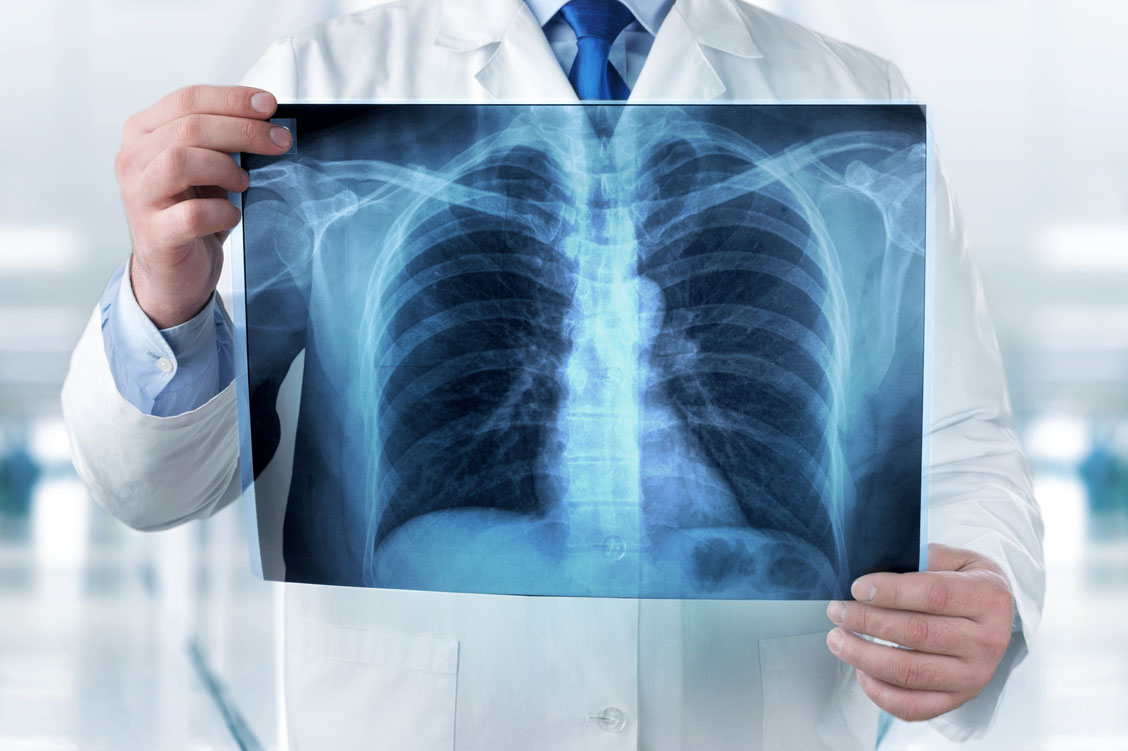 Eine aktuelle Studie zeigt: Bestimmte Berufe erhöhen das Risiko, an COPD zu erkranken. / Foto: Adobe Stock/BillionPhotos.com