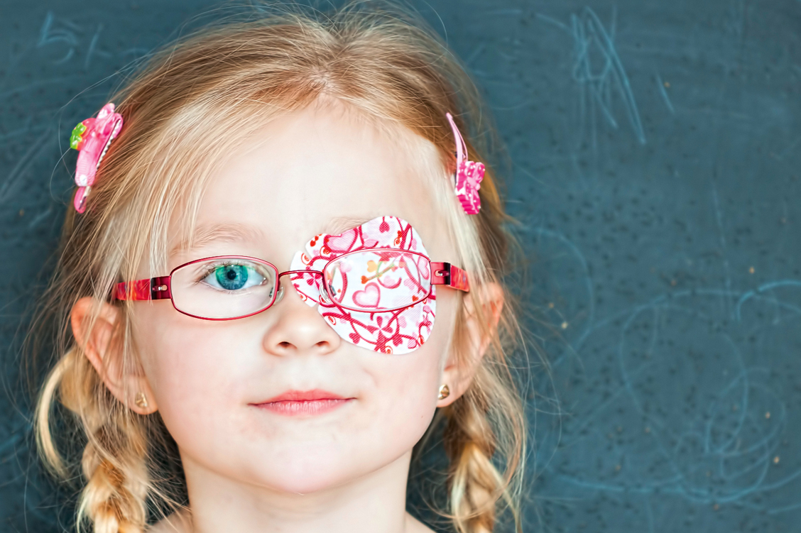 Okklusionspflaster gibt es mit verschiedenen bunten Motiven für Kinder. Sie sind in der Regel hypoallergen und auch für empfindliche Haut geeignet. / Foto: Shutterstock/Juraj Kovac